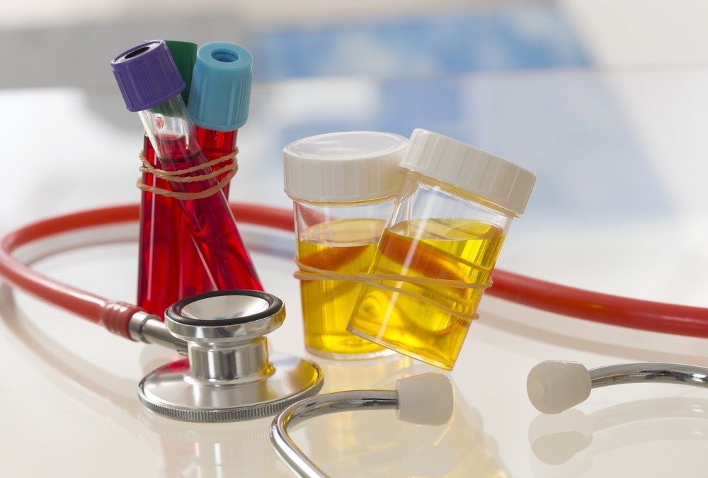 Stores That Sell Synthetic Urine Near Me Foxwood Lakeland FL Purity